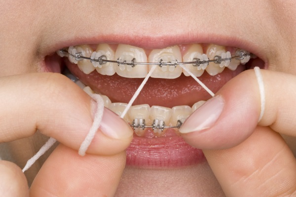 ortodoncia-en-niños